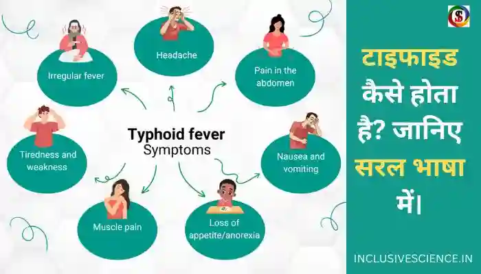 Typhoid disease, टाइफाइड